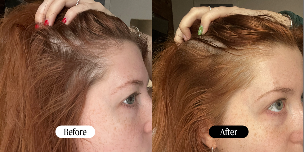 DIY Hair Serum for Dry Hair Recipe